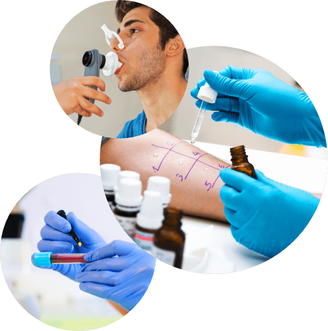 Asma alérgica - Hombre con aparato de prueba respiratória, prueba cutánea, tubo con sangre
